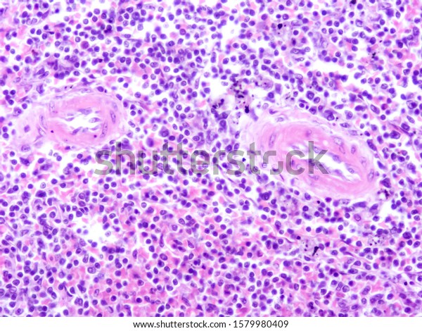 Picture Histology Human Spleen Tissue Microscope Stock Photo 1579980409 ...