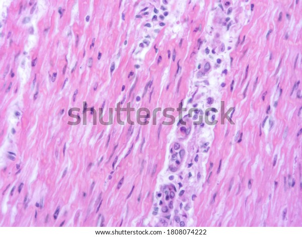 Picture Histology Human Tissue Microscope Laboratory Stock Photo (Edit ...