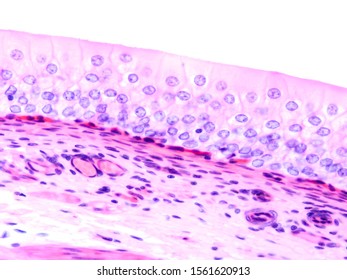 Picture Histology Human Urinary Bladder Tissue Stock Photo 1561620913 ...