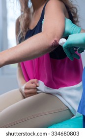 Picture Of Injured Girl With Bloody Wound On Elbow