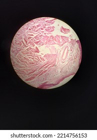 Picture Or Mircograph Of Thick Skin Through A Light Microscope 