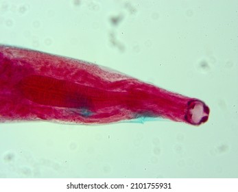 Picture Of Necator Americanus Parasite