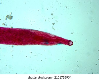 Picture Of Necator Americanus Parasite