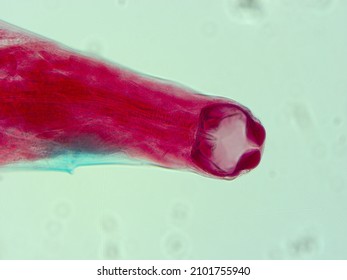 Picture Of Necator Americanus Parasite