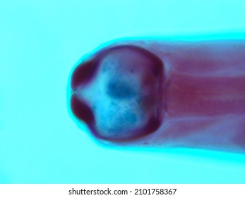 Picture Of Necator Americanus  Parasite