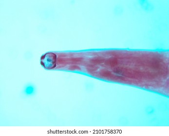 Picture Of Necator Americanus  Parasite