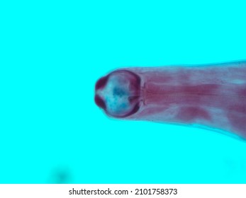 Picture Of Necator Americanus  Parasite