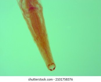 Picture Of Necator Americanus  Parasite