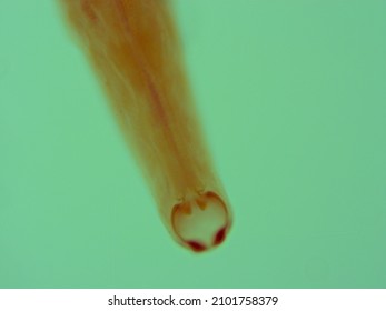 Picture Of Necator Americanus  Parasite