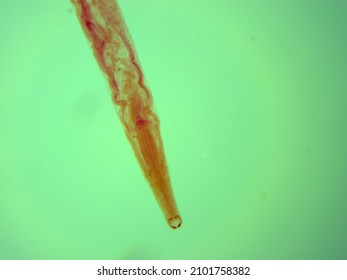 Picture Of Necator Americanus  Parasite