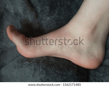 Picture of a pretty foot