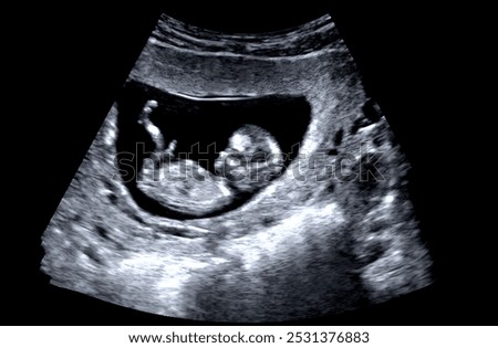 The picture shows an ultrasound scan of a foetus in the uterus, 12 weeks after fertilisation.