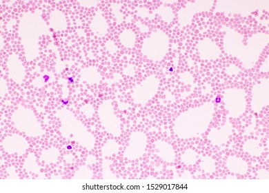 Picture White Blood Cell Red Blood Stock Photo 1529017844 | Shutterstock