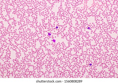 Picture White Blood Cell Red Blood Stock Photo 1529017838 | Shutterstock