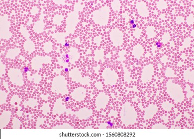 Picture White Blood Cell Red Blood Stock Photo 1560808292 | Shutterstock