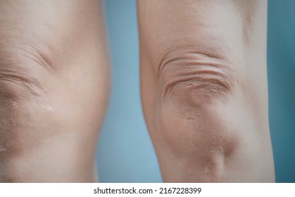 Picture Of Wrinkles On The Skin Of Different Parts Of The Human Body.