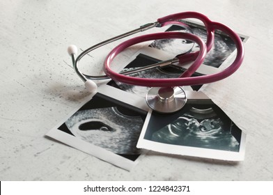 In the pictures of the ultrasound 4 weeks of pregnancy and 20 weeks is a phonendoscope. The concept of the study of pregnancy. Observation Selective focus - Powered by Shutterstock