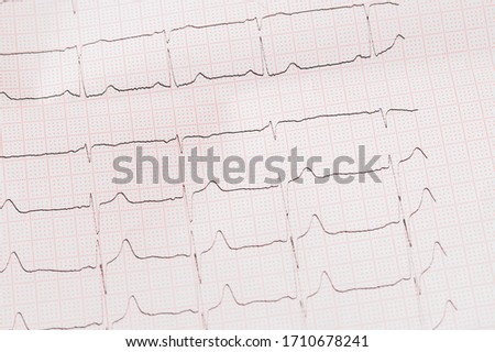 a piece of a electrocardiogram close up. selective focus, tinted image