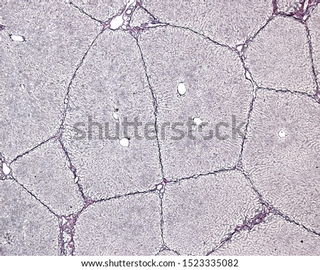 Pig liver. Silver technique for reticular fibres. In this species, the hepatic lobules are surrounded by interlobular connective tissue spaces, which make visible the polygonal shape of lobules  Stock photo © 
