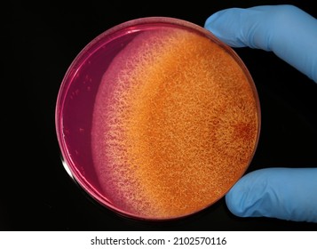 Pigmented Colony Of A Fungus (microorganism) Growing On A Microbiological Culture Plate In A Microbiology Laboratory