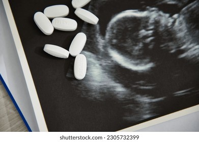 Pills for pregnant women with vitamins and microelements scattered over the ultrasound of the baby. Prescribing folic acid-rich supplements to maintain a healthy pregnancy. Gynecology. Selective focus - Powered by Shutterstock