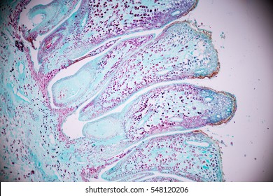 Pine Cone Pine Ovulate On Slide Stock Photo 548120206 | Shutterstock