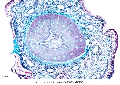 Pine root, cross section, under the microscope. Root of a conifer, cut perpendicular to longitudinal axis, hematoxylin-eosin stained, shot with 4X objective and 2X camera adapter. Scale in mm. Photo
