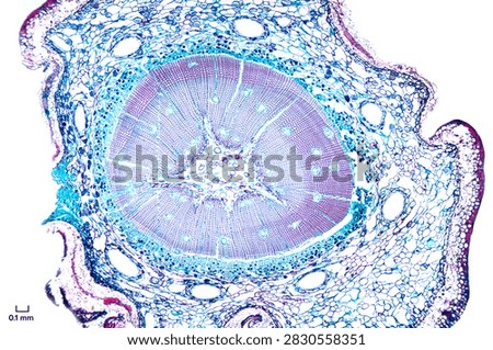 Pine root, cross section, under the microscope. Root of a conifer, cut perpendicular to longitudinal axis, hematoxylin-eosin stained, shot with 4X objective and 2X camera adapter. Scale in mm. Photo