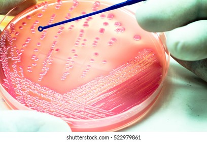 Pink Bacteria Lactose Ferment Colonies Culture Growth On MacConkey Agar Media In Experimental Laboratory Hospital White Background