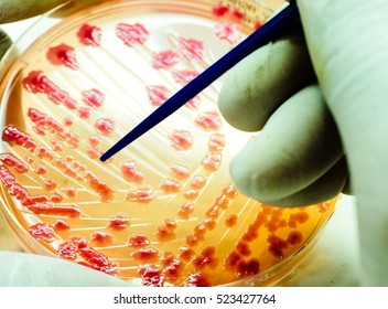 Pink Bacteria Lactose Ferment Colonies Culture Growth On MacConkey Agar Media In Experimental Laboratory Hospital White Background