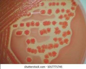 Pink Colony Of Citrobacter Spp. On Macconkey Agar Plate