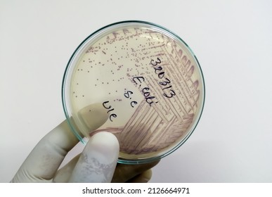 Pink Colony Of Escherichia Coli (E. Coli) On MacConkey Medium In Plastic Petri Dish.