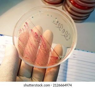 Pink Colony Of Escherichia Coli (E. Coli) On MacConkey Medium In Plastic Petri Dish. Sub Culture.