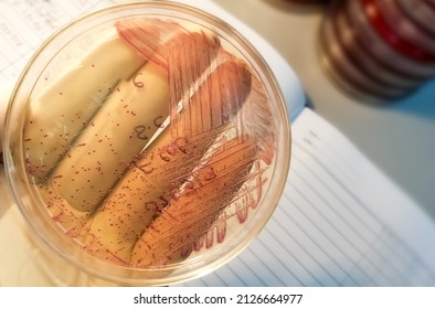 Pink Colony Of Escherichia Coli (E. Coli) On MacConkey Medium In Plastic Petri Dish