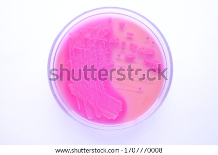 Pink Escherichia coli colony morphology on MacConkey agar plate