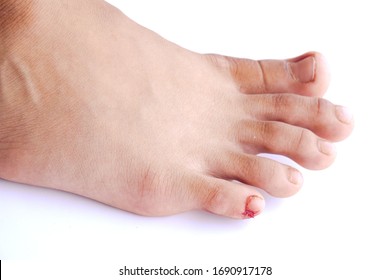 Pinky Toe Images, Stock Photos & Vectors | Shutterstock