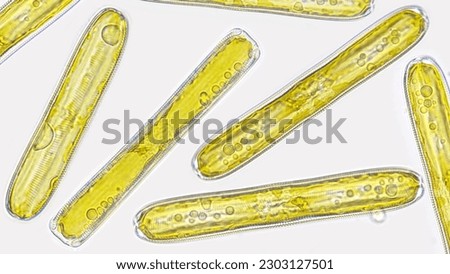 Pinnularia sp. a freshwater phytoplankton belonging diatom group, under microscope. 400x magnification. Selective focus