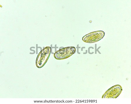 Pinworm eggs (Enterobius vermicularis) on stool examination. Asymmetrical egg shape.