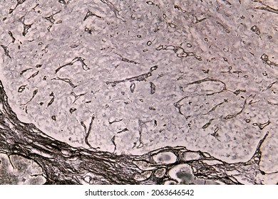 Pituitary Posterior Lobe. Silver Method For The Demonstration Of Reticular Fibers. On Bottom, The Connective Tissue Capsule