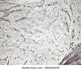 Pituitary Posterior Lobe. Silver Method For The Demonstration Of Reticular Fibers. On Bottom, The Connective Tissue Capsule