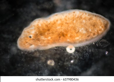 Planarian parasite (flatworm) under microscope view.