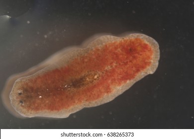 Planarian Parasite (flatworm) Under Microscope View.