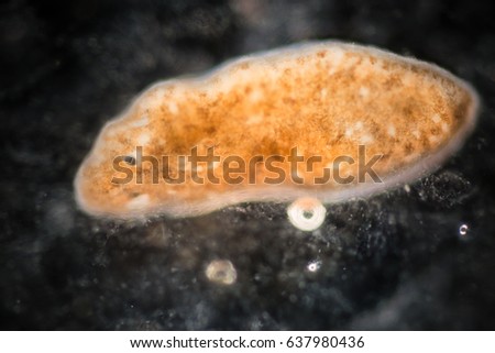 Planarian parasite (flatworm) under microscope view.