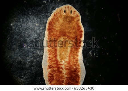 Planarian parasite (flatworm) under microscope view.