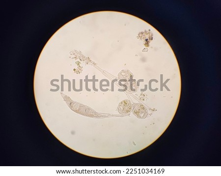 plankton in water, wanderer, ecosystem, organism, Zooplankton