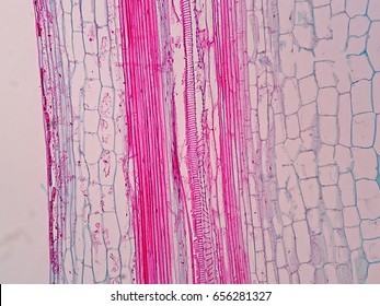 Plant Vascular Tissue Under Microscope View.