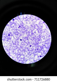 Plasmodium Falciparum Gametocyte