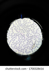 Plasmodium Vivax In Slide Thin Film