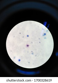 Plasmodium Vivax In Slide Thin Film