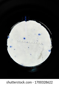 Plasmodium Vivax In Slide Thin Film